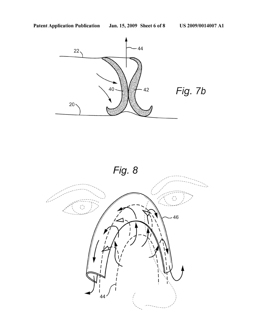 PATIENT INTERFACE AND NON-INVASIVE POSITIVE PRESSURE VENTILATING METHOD - diagram, schematic, and image 07