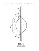 Toroidal endotracheal cuffs for ventilator associated pneumonia reduction diagram and image