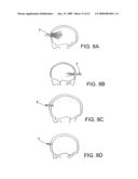 RADIOLUCENT FASTENING DEVICES FOR SECURING A PART OF A BODY DURING A MEDICAL PROCEDURE diagram and image