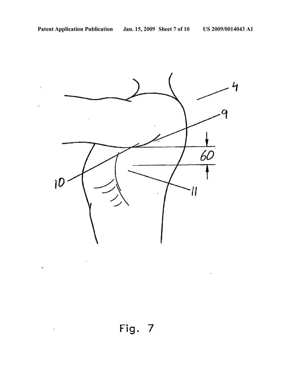 Ambulation Assistance Apparatus and Methods - diagram, schematic, and image 08