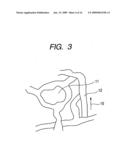 Structure, porous body, sensor, process of structure and detecting mehod for specimen diagram and image