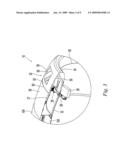 AIRCRAFT ENGINE NACELLE INLET HAVING ACCESS OPENING FOR ELECTRICAL ICE PROTECTION SYSTEM diagram and image