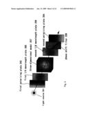 Catheter Surgery Simulation diagram and image