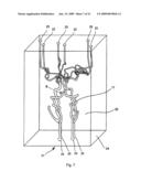 Catheter Surgery Simulation diagram and image