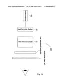 Catheter Surgery Simulation diagram and image