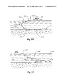 Non-rigid cable for deployment of ocean bottom seismometers diagram and image