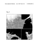 Computer-Assisted Detection of Colonic Polyps Using Convex Hull diagram and image