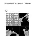 Computer-Assisted Detection of Colonic Polyps Using Convex Hull diagram and image