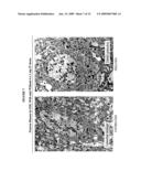 Delivery of Therapeutic Compounds to the Brain and Other Tissues diagram and image