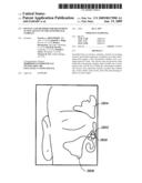 DEVICES AND METHODS FOR DELIVERING ACTIVE AGENTS TO THE OSTEOMEATAL COMPLEX diagram and image