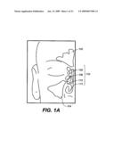 DEVICES AND METHODS FOR DELIVERING ACTIVE AGENTS TO THE OSTEOMEATAL COMPLEX diagram and image