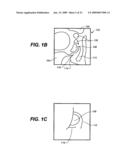 DEVICES AND METHODS FOR DELIVERING ACTIVE AGENTS TO THE OSTEOMEATAL COMPLEX diagram and image