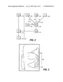 DEVICES AND METHODS FOR DELIVERING ACTIVE AGENTS TO THE OSTEOMEATAL COMPLEX diagram and image