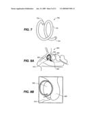 DEVICES AND METHODS FOR DELIVERING ACTIVE AGENTS TO THE OSTEOMEATAL COMPLEX diagram and image