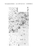 Methods For Regulating The Growth And/Or Survival Of Tumor Cells And Stem Cells By Modulating The Expression Or Function Of The Transcription Factor ATF5 diagram and image