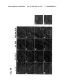 Methods For Regulating The Growth And/Or Survival Of Tumor Cells And Stem Cells By Modulating The Expression Or Function Of The Transcription Factor ATF5 diagram and image