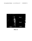 Compositions of phospholipid ether boronic acids and esters and methods for their synthesis and use diagram and image