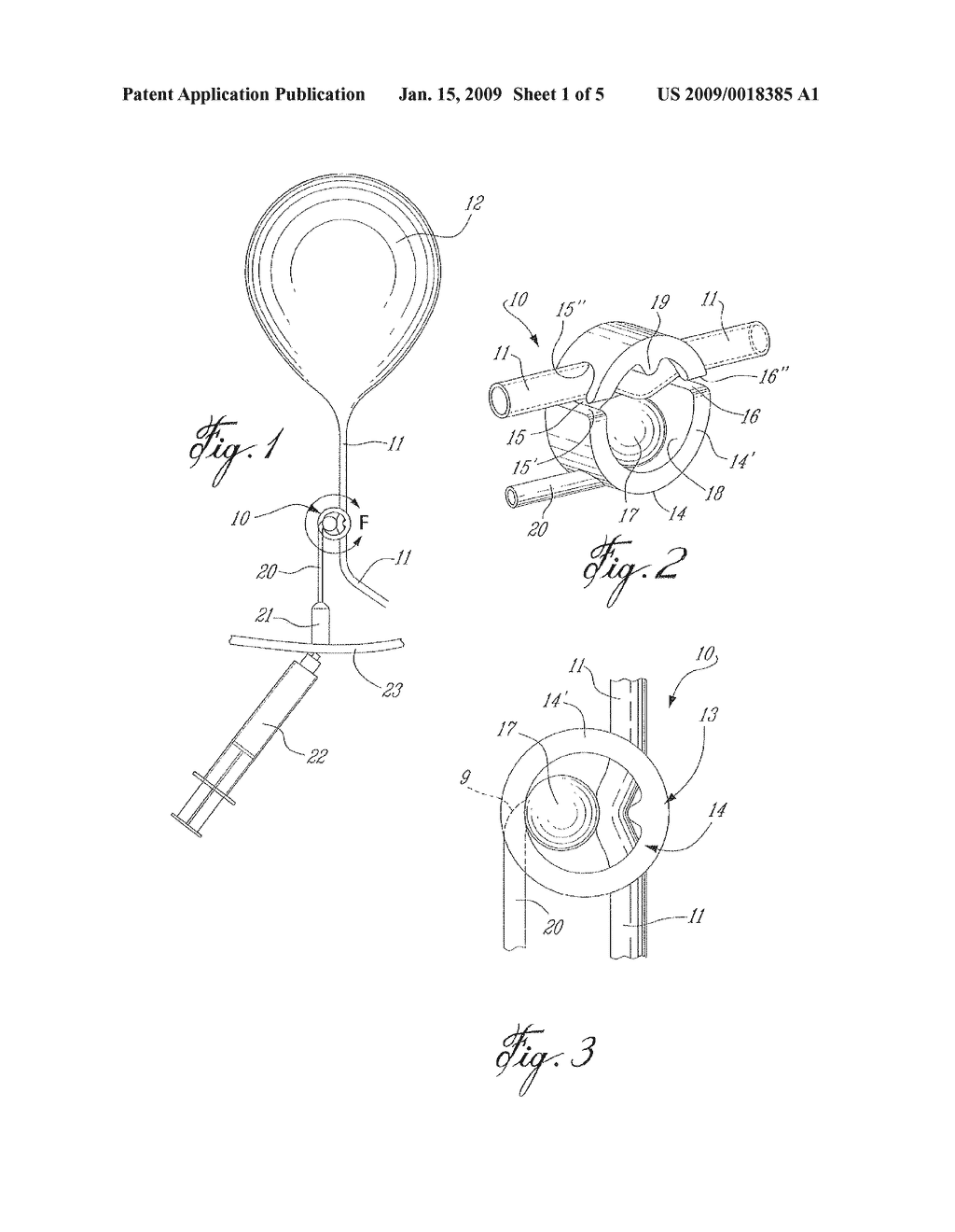 URETHRA PRESSURE CONTROL VALVE TO CONTROL INCONTINENCE - diagram, schematic, and image 02