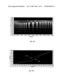 CATHETER FOR IN VIVO IMAGING diagram and image