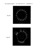 CATHETER FOR IN VIVO IMAGING diagram and image