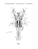 Surgical access system and related methods diagram and image