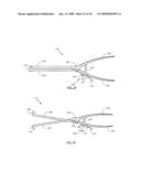 Surgical access system and related methods diagram and image