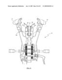 Surgical access system and related methods diagram and image