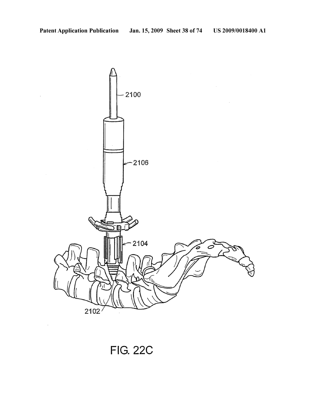 SURGICAL RETRACTOR SYSTEMS AND ILLUMINATED CANNULAE - diagram, schematic, and image 39