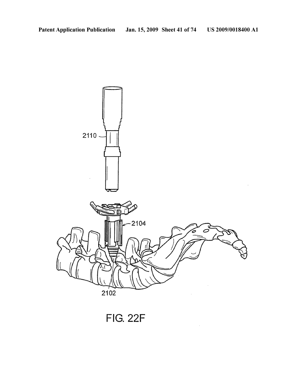 SURGICAL RETRACTOR SYSTEMS AND ILLUMINATED CANNULAE - diagram, schematic, and image 42