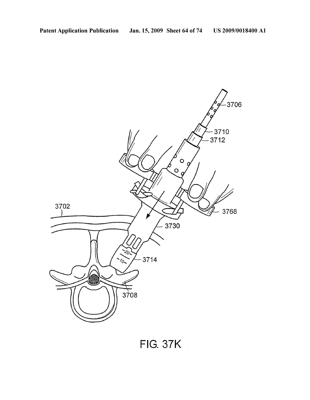 SURGICAL RETRACTOR SYSTEMS AND ILLUMINATED CANNULAE - diagram, schematic, and image 65