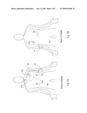 DEVICE FOR DETERMINING RESPIRATORY RATE AND OTHER VITAL SIGNS diagram and image