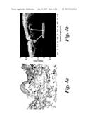 OPTICAL COHERENCE TOMOGRAPHY diagram and image