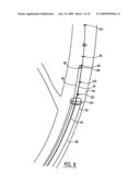 SYSTEMS AND METHODS FOR INTRAVASCULAR COOLING diagram and image