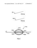 Devices and Methods for Perfusing an Organ diagram and image