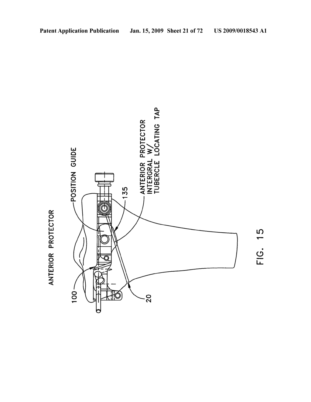 Method and apparatus for performing an open wedge, high tibial osteotomy - diagram, schematic, and image 22