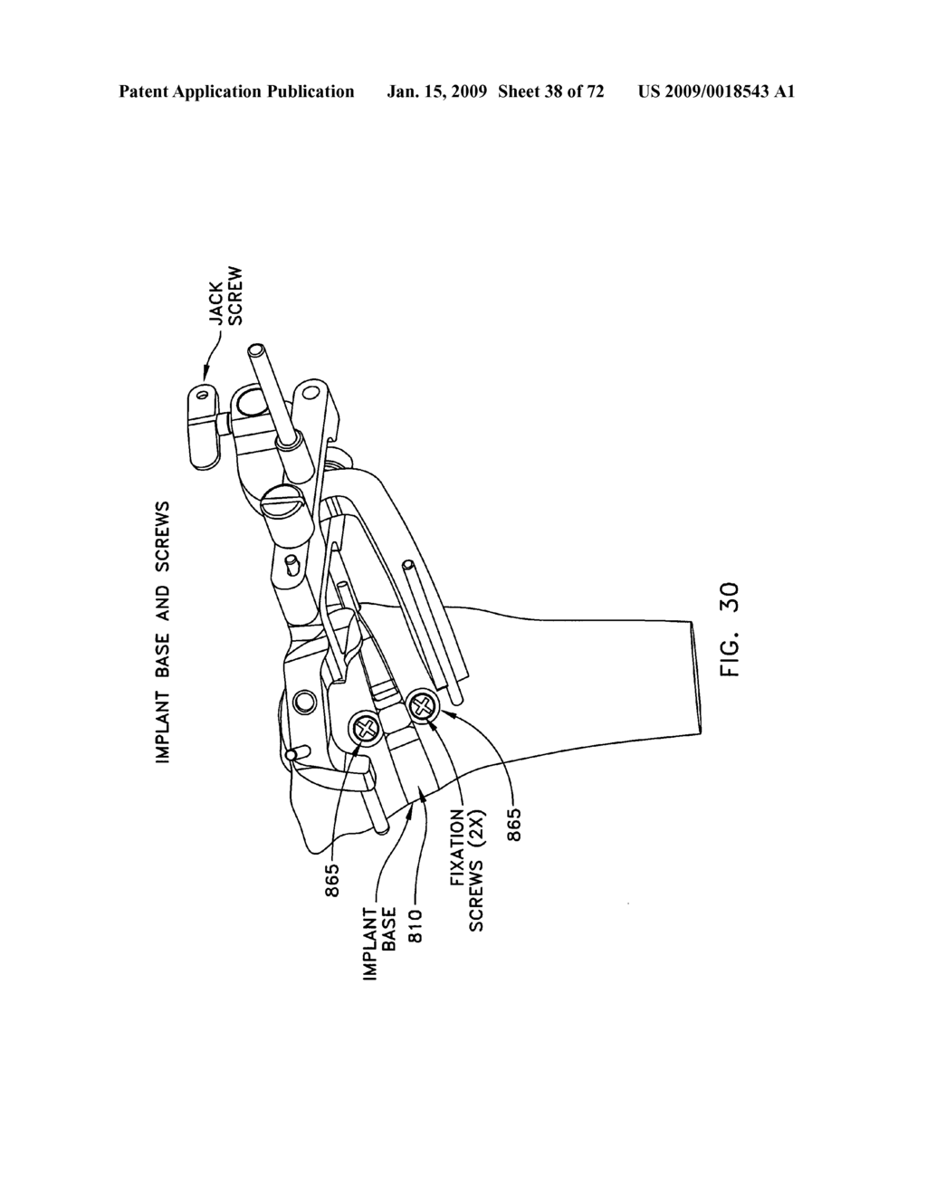 Method and apparatus for performing an open wedge, high tibial osteotomy - diagram, schematic, and image 39