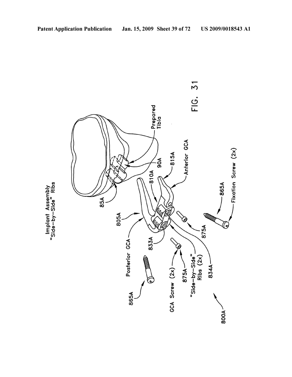 Method and apparatus for performing an open wedge, high tibial osteotomy - diagram, schematic, and image 40