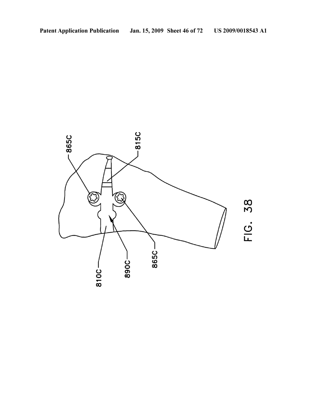 Method and apparatus for performing an open wedge, high tibial osteotomy - diagram, schematic, and image 47