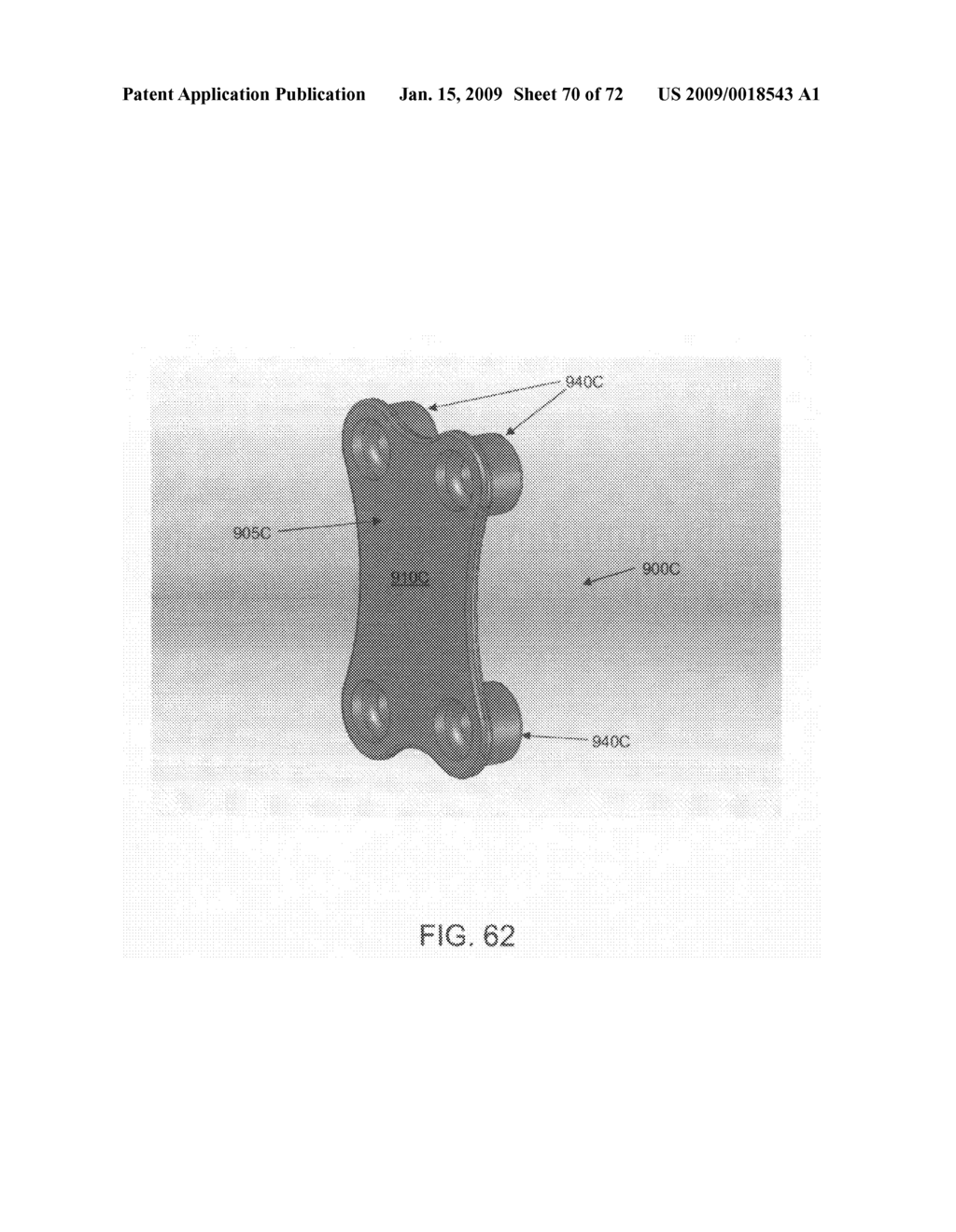 Method and apparatus for performing an open wedge, high tibial osteotomy - diagram, schematic, and image 71