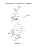 MULTI-ACTUATING TRIGGER ANCHOR DELIVERY SYSTEM diagram and image