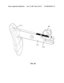 MULTI-ACTUATING TRIGGER ANCHOR DELIVERY SYSTEM diagram and image