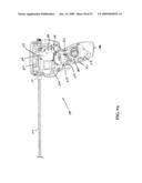 MULTI-ACTUATING TRIGGER ANCHOR DELIVERY SYSTEM diagram and image