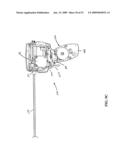 MULTI-ACTUATING TRIGGER ANCHOR DELIVERY SYSTEM diagram and image