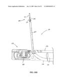 MULTI-ACTUATING TRIGGER ANCHOR DELIVERY SYSTEM diagram and image