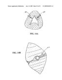 MULTI-ACTUATING TRIGGER ANCHOR DELIVERY SYSTEM diagram and image