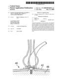 SYSTEM AND METHOD FOR ATTACHING A VEIN, AN ARTERY, OR A TUBE IN A VASCULAR ENVIRONMENT diagram and image