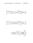 SYSTEM AND METHOD FOR ATTACHING A VEIN, AN ARTERY, OR A TUBE IN A VASCULAR ENVIRONMENT diagram and image