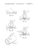 SYSTEM AND METHOD FOR ATTACHING A VEIN, AN ARTERY, OR A TUBE IN A VASCULAR ENVIRONMENT diagram and image