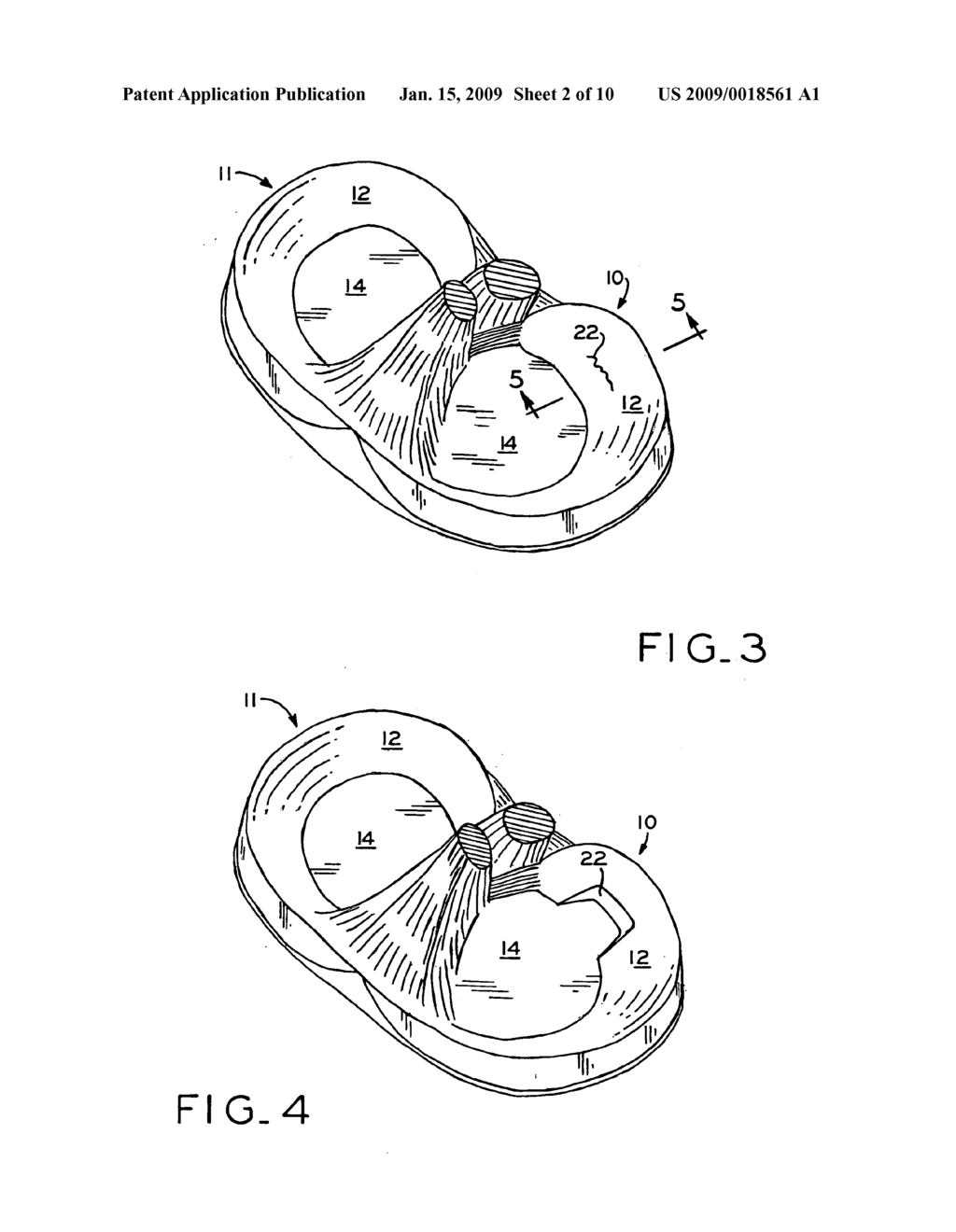 Medical device for repair of tissue and method for implantation and fixation - diagram, schematic, and image 03