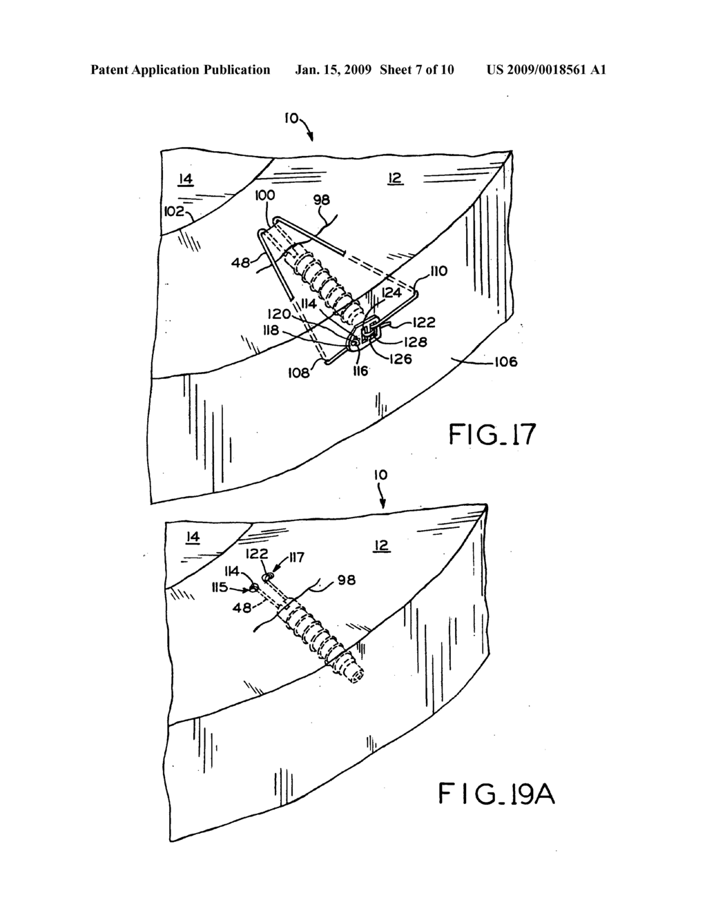 Medical device for repair of tissue and method for implantation and fixation - diagram, schematic, and image 08